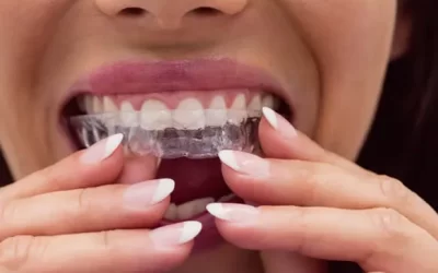 Invisalign San Jose: Clear Aligner Therapy for Discreet Orthodontic Correction